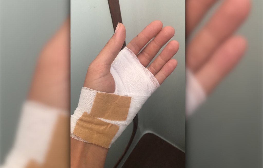 That's how the situation looks like.